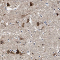 PNMA-like 1 Antibody, Novus Biologicals:Antibodies:Primary Antibodies